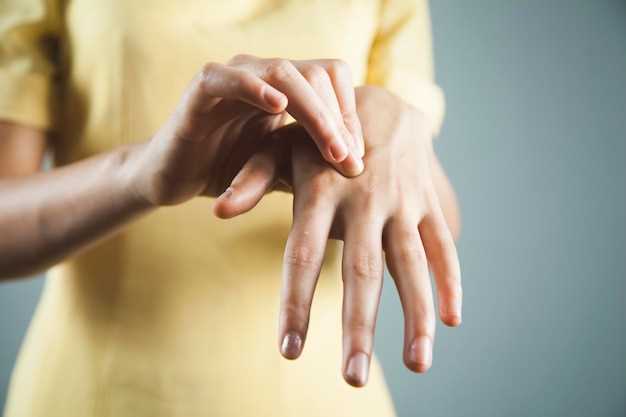 Причины, по которым кожа рук становится сухой и трескается