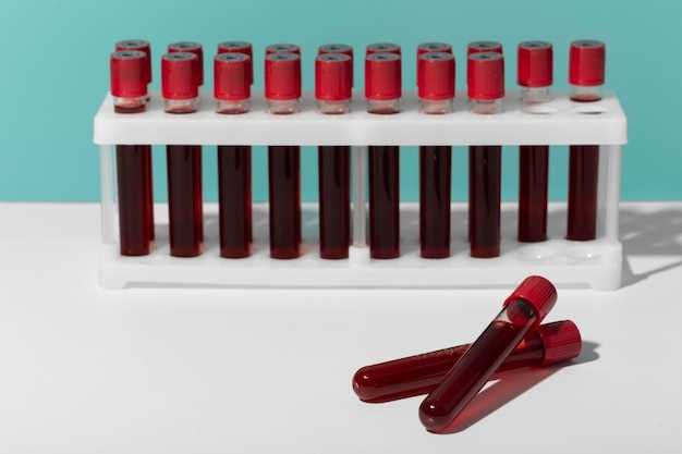Как определить группу крови и резус фактор самостоятельно