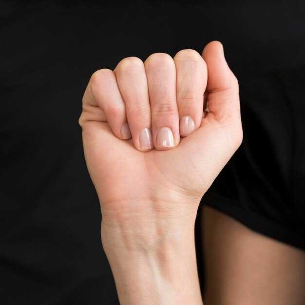 Симптомы псориаза на ногтях