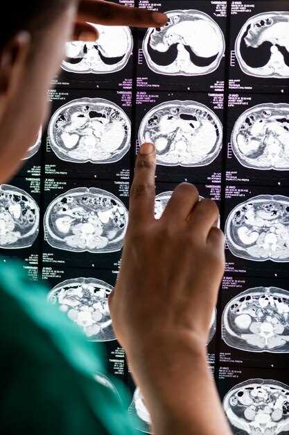 МРТ головного мозга: диагностика и расшифровка результатов