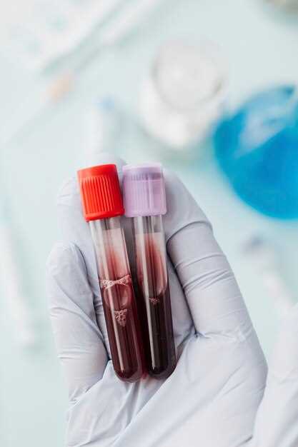 Как правильно сдавать общий анализ крови