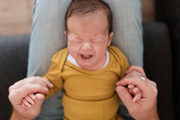 Причины возникновения желтушки у новорожденных