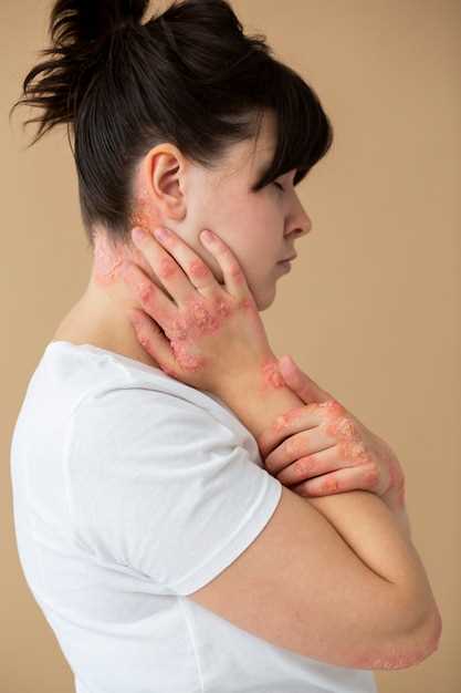 Воспаление лимфоузла на шее слева: основные причины